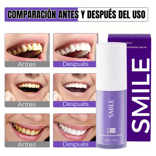 PROMOCION 50%OFF - PURPLE SMILE BLANQUEAMIENTO DENTAL